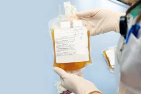 UP: KGMU में देश के सबसे बड़े प्लाज़्मा सेंटर की शुरुआत, COVID-19 से जंग में मिलेगी मदद UP: KGMU में देश के सबसे बड़े प्लाज़्मा सेंटर की शुरुआत, COVID-19 से जंग में मिलेगी मदद