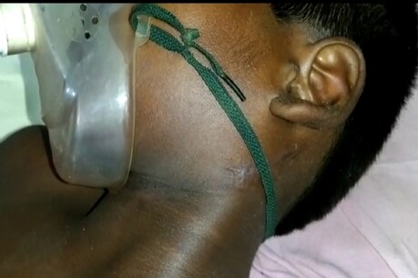 अस्पताल में इलाज के लिए भर्ती पीड़ित बच्चा.