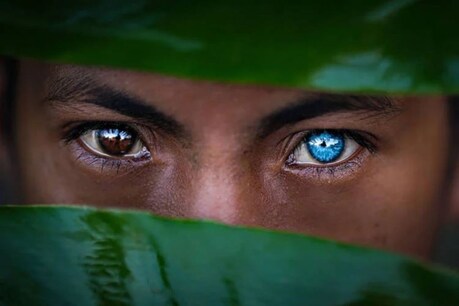 Mata banyak orang suku lokal di Indonesia berubah menjadi biru pucat karena sakit (Foto-foto Instagram fotografer Indonesia Korchanoi Pasaribu)