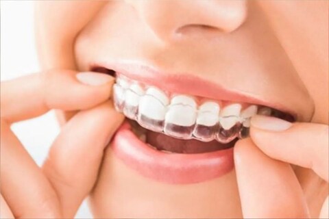 नमक और सरसों के तेल से दांतों का पीलापन दूर किया जा सकता है. 