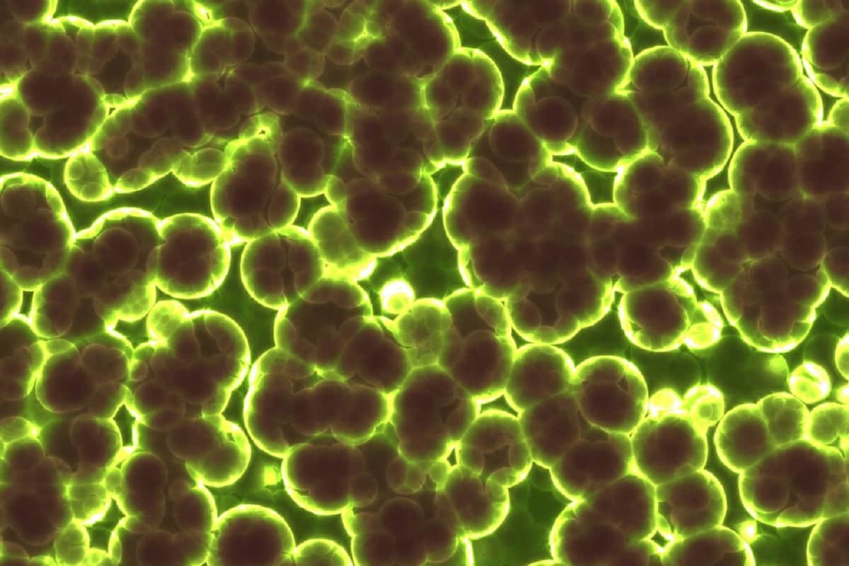 , Energy, Photosynthesis, Hydrogen, Oxygen, algal cells, Droplet,