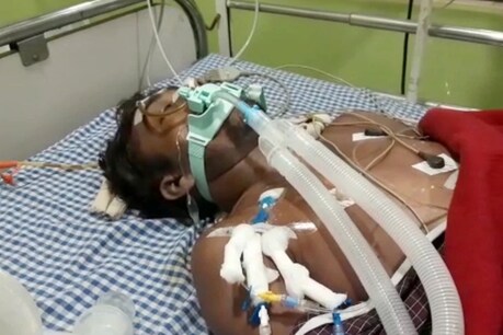 कटनी दोस्त के मजाक से युवक की जान पर बन आई.