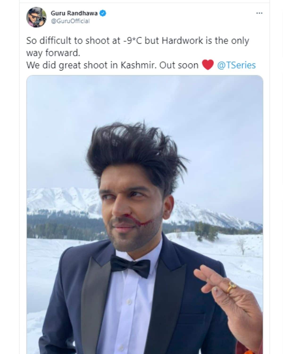guru randhawa, kashmir, guru randhawa nose bleeding, guru randhawa in kashmir, guru randhawa project, guru randhawa image, guru randhwa instagram, guru randhawa, kashmir, guru randhawa shooting, mehndi wale haath, bollywood news in hindi, news18 hindi