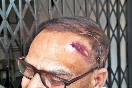 हमीरपुर में हमले में घायल आईपीएच विभाग का अधिकारी.