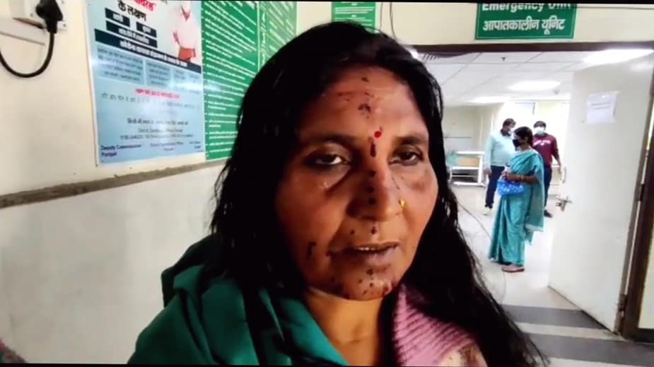 पानीपत में लड़ाई में घायल महिला।