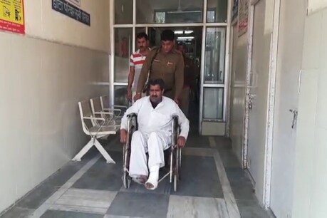 पुलिस से बचने के लिए आरोपी ने अपना ही पैर तोड़ डाला