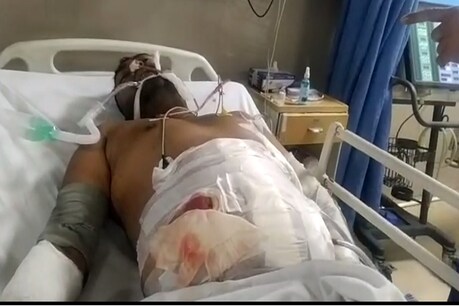 लिफ्ट देना वाल शख्स अब अस्पताल में जिंदगी और मौत से जूझ रहा है.