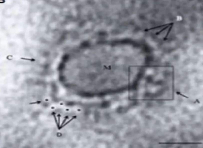 corona virus research, corona virus study, first case of corona, corona virus discovery, कोरोना वायरस रिसर्च, कोरोना वायरस खोज, कोरोना वायरस का पहला केस, कोरोना वायरस स्टडी