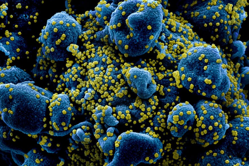 triple mutant variant coronavirus