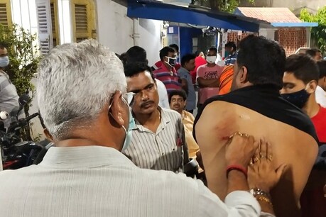 केंद्रीय मंत्री शेखावत के काफिले पर हुए हमले में जख्मी बीजेपी का एक कार्यकर्ता.