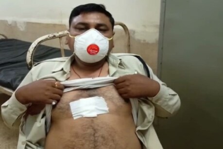 आरक्षक पर हमला करने वाला आरोपी इलाके का कुख्यात बदमाश है.