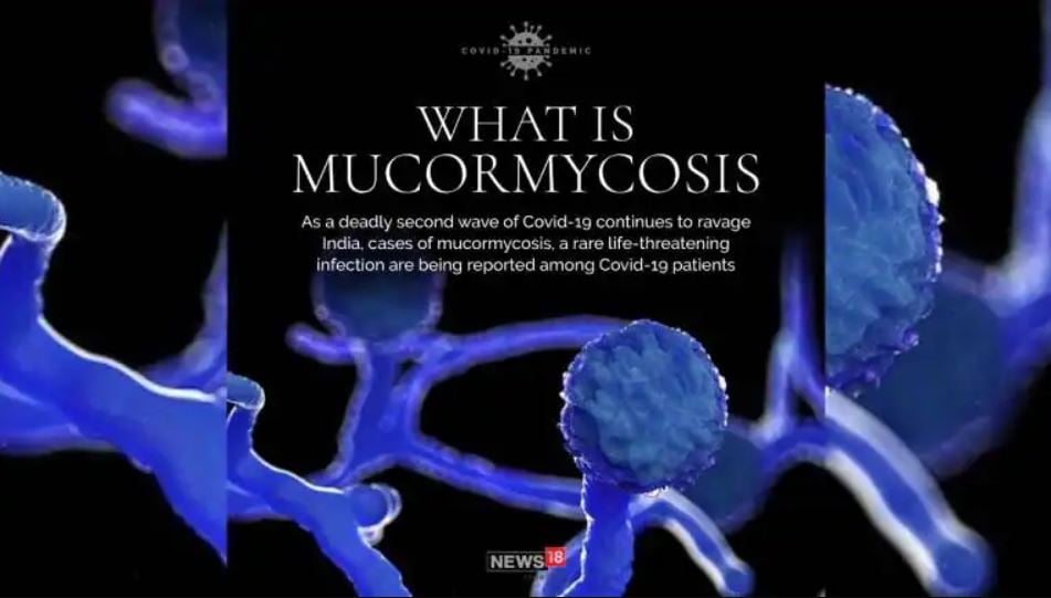 madhya pradesh news, black fungus in madhya pradesh, black fungus symptoms, black fungus treatment, मध्य प्रदेश न्यूज़, मध्य प्रदेश में ब्लैक फंगस, ब्लैक फंगस के लक्षण, ब्लैक फंगस का इलाज