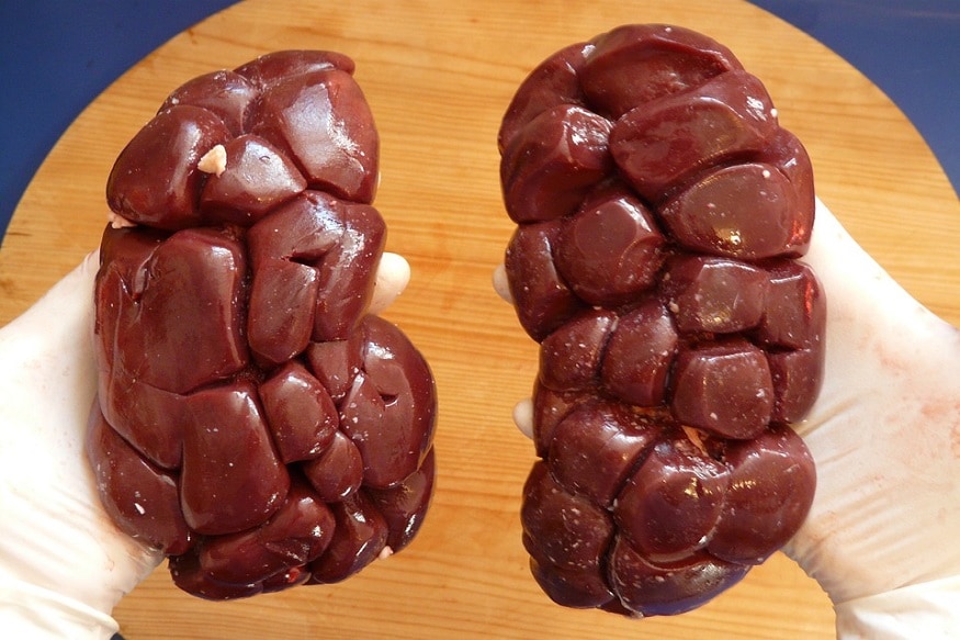 water intoxication and kidney