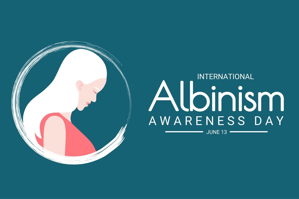 International Albinism Awareness Day 2021, Albinism, United Nations, theme, Strength beyond All Odds,