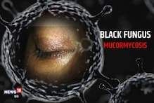 Black Fungus: क्यों-कैसे होता है ब्लैक फंगस? IGMC शिमला के डॉक्टर्स करेंगे शोध