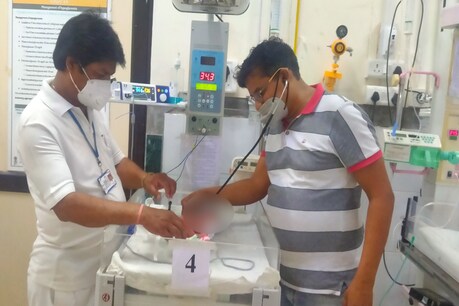 अस्पताल स्टाफ नवजात को एनजी ट्यूब से मदर मिल्क बैंक का दूध पिला रहा है. वहीं उसका समुचित इलाज भी किया जा रहा है. 