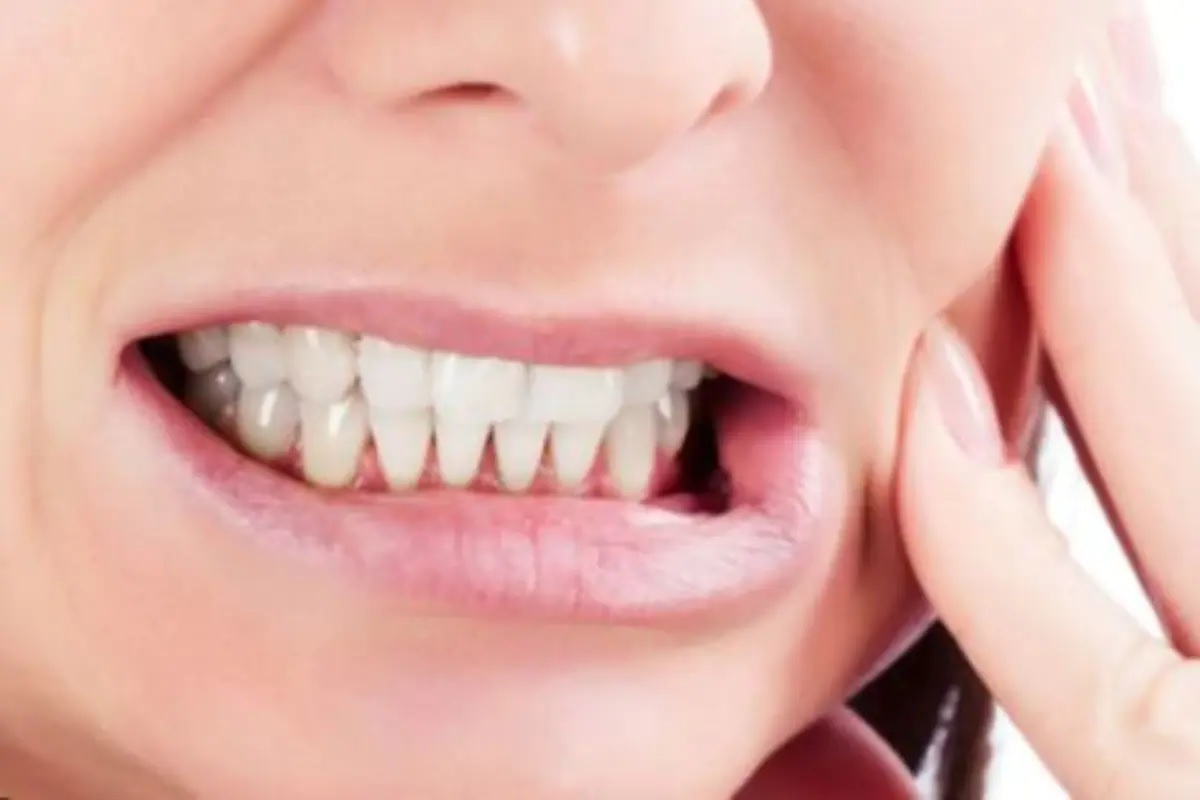 कोरोना के बाद से देश में दांतों के मरीजों की संख्‍या बढ़ी है. 