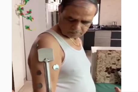 नासिक के अरविंद जगन्नाथ सोनार के शरीर में चिपक रहे स्टील के बर्तन.