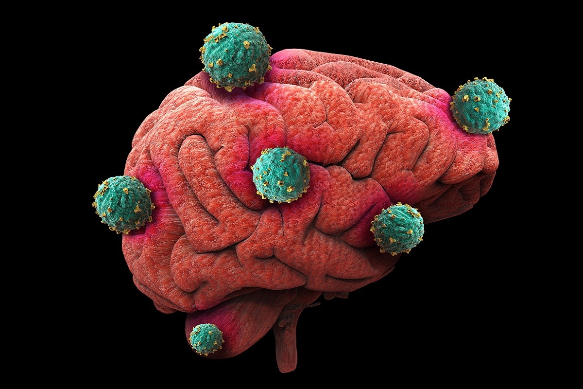 Health, Brain, Spirituality, Brain Circuit, Human Brain, Neurology, Neurosurgery