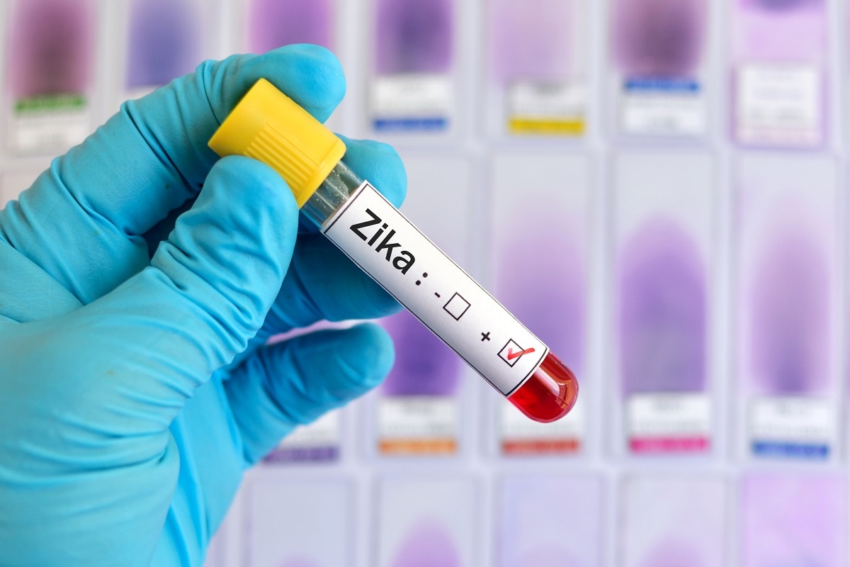 Health, zika virus, zika virus symptoms, zika virus kerala, zika virus in kerala, Aedes aegypti, Precaution, Preventive measures, symptoms,