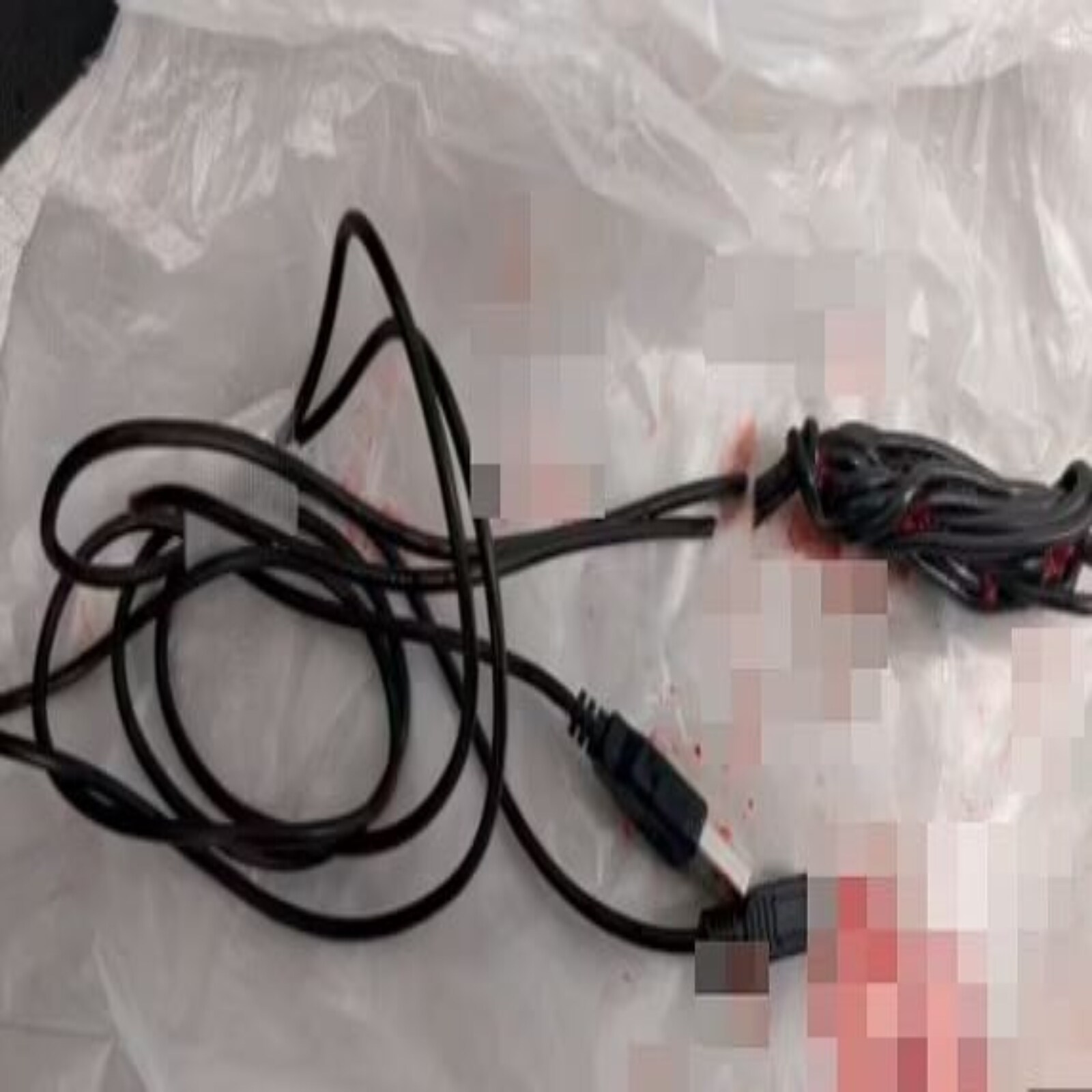 जवानी की मस्ती पड़ी किशोर को महंगी, प्राइवेट पार्ट के अंदर ऐसे फंस गया