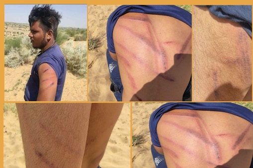 A Dalit youth has been brutally beaten up in Jaisalmer.