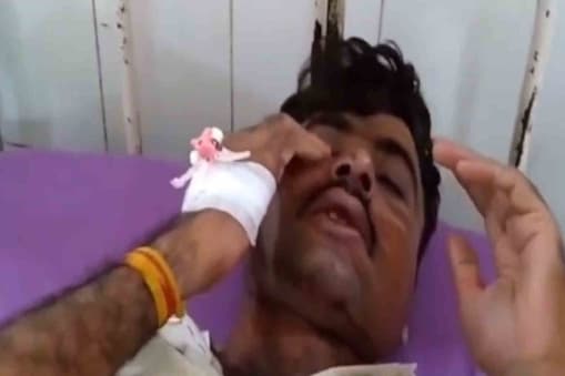 The injured constable has been admitted to Barmer District Hospital. There he is undergoing treatment.