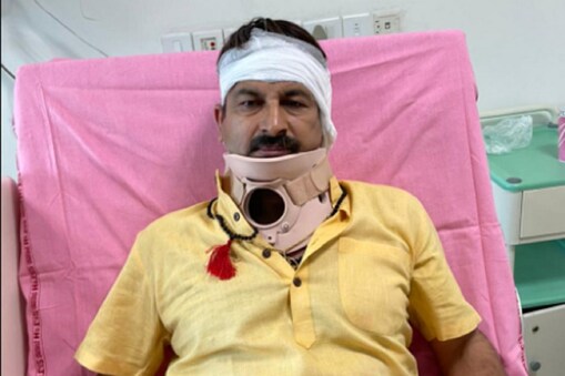 Delhi bjp mp manoj tiwari injured during protest admitted to hospital nodbk - दिल्ली: BJP सांसद मनोज तिवारी हुए घायल, सफदरजंग अस्पताल में कराया गया भर्ती – News18 Hindi