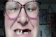 Shocking: प्राइवेट डेंटिस्ट की फीस देख महिला ने खुद ही उखाड़ डाले अपने दांत!