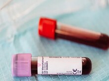 NFHS-5: देश में बच्‍चों और महिलाओं की आधी से ज्‍यादा आबादी में खून की कमी