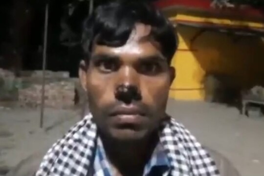 It is alleged that when Manoj came to Shahabad to demand money, Pradhan Vivek Pandey beat him up.