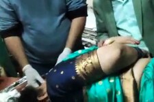 UP में फिर हर्ष फायरिंग, अब नशे में सिरफिरे ने चलाई गोली महिला के सिर में लगी