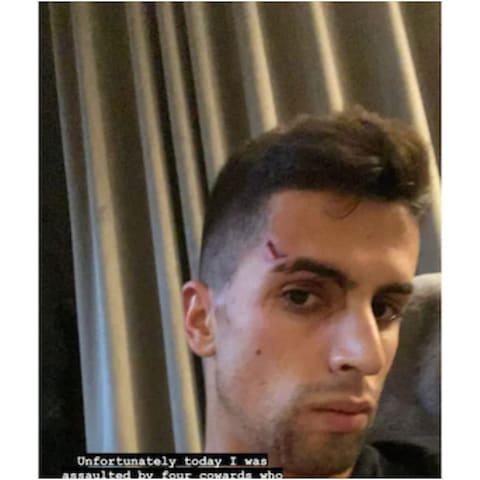 Deadly attack on Ronaldo's fellow footballer, dacoits did not even leave family Deadly attack on Ronaldo's fellow footballer, dacoits did not even leave family