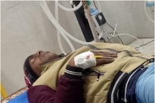 दिल्‍ली पुलिस की फायरिंग में स्नैचर राकेश ऊर्फ हड्डी घायल, हैरान कर देगी कहानी