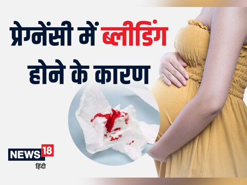 प्रेग्नेंसी के दौरान क्यों होती है ब्लीडिंग? जानें कारण और बचाव के उपाय. news18