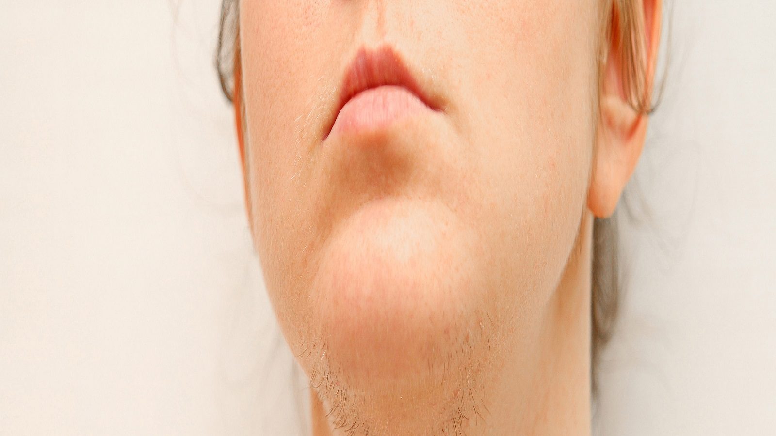 home remedies to remove hair on chin Hindustan News Hub home remedies to remove hair on chin Hindustan News Hub