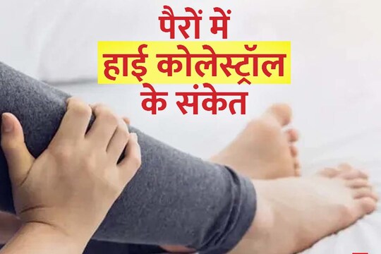 आपके पैर और तलवे हमेशा ठंडे रहते हैं, तो ये हाई कोलेस्ट्रॉल के संकेत हो सकते हैं.