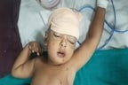 PHOTOS: मासूम के मुंह में घुसा स्टील का टिफिन, 7 घंटे के ऑपरेशन के बाद मिला नया जीवन