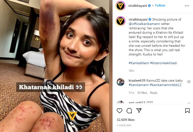 Kanika Mann injured, Kanika Mann Khatron ke Khiladi 12, Kanika Mann Photo, Kanika Mann injuries, Kanika Mann Instagram, कनिका मान, 'खतरों के खिलाड़ी 12