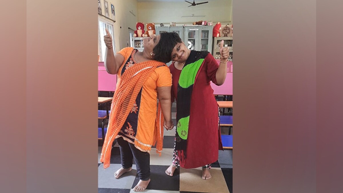 हैदराबादः सिर से जुड़ी दो बहनों ने फर्स्ट डिवीजन से पास किया इंटरमीडिएट CA बनने का है सपना