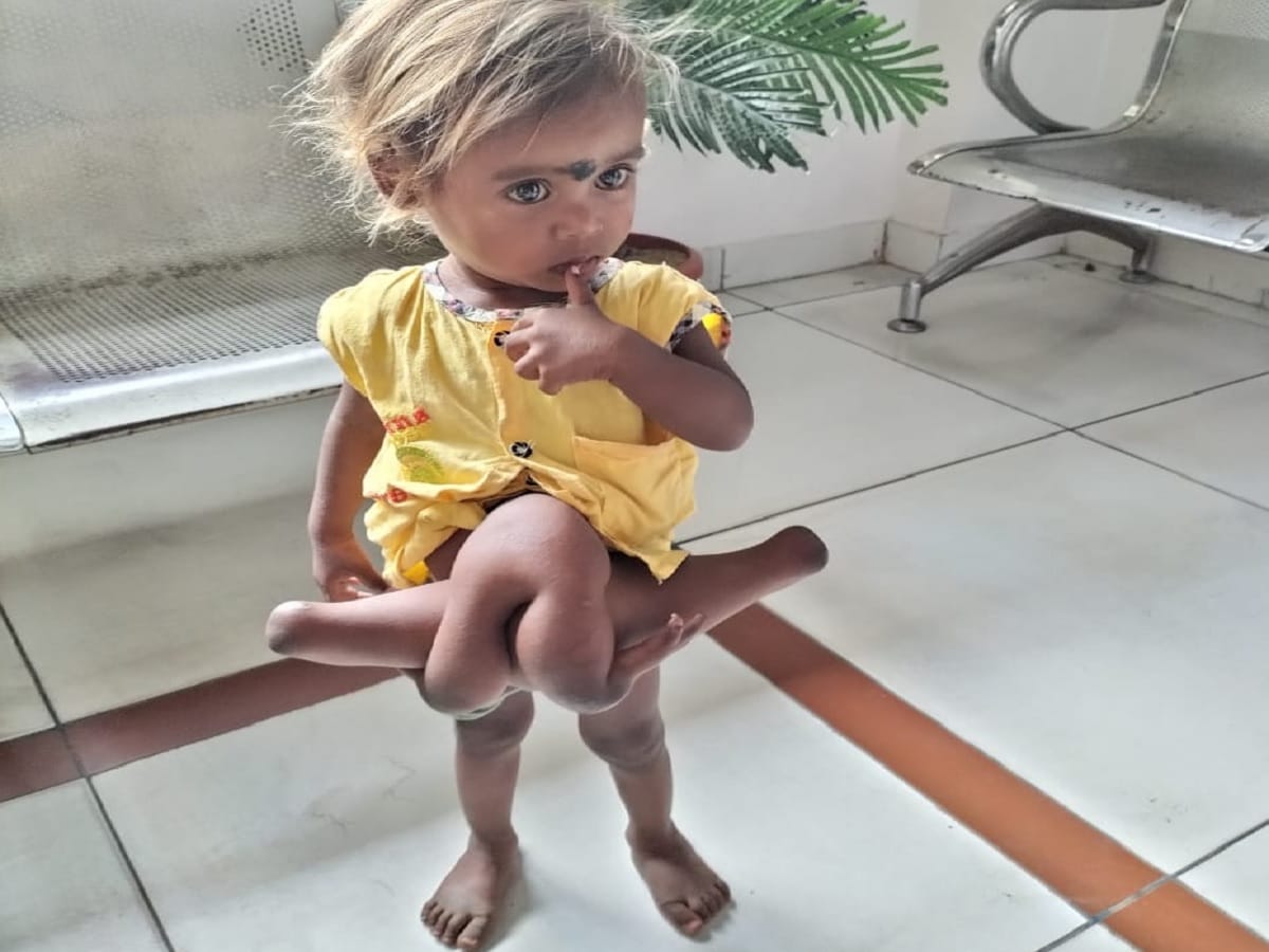 4 hand 4 leg girl child