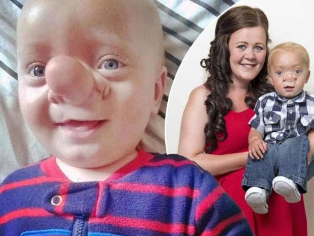 10 Weird Diseases Realitypod Part 2 vrogue.co