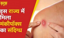 Monkeypox: केरल में मिला Monkeypox का संदिग्ध, यहां से लौटा है यह शख्स | KADAK | Latest Hindi News
