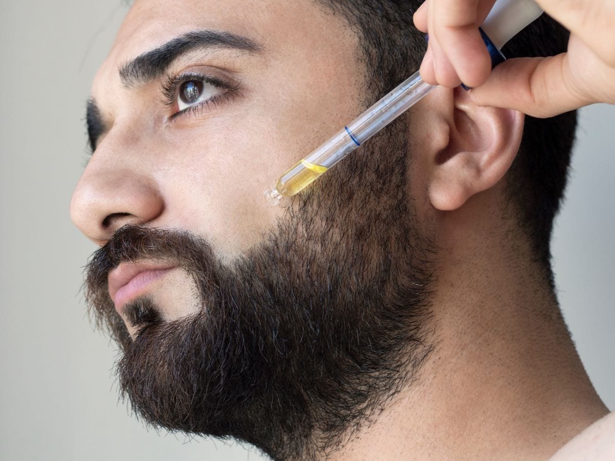 If there are problems with dandruff and itching in the beard, then adopt these 5 tips, you will get rest