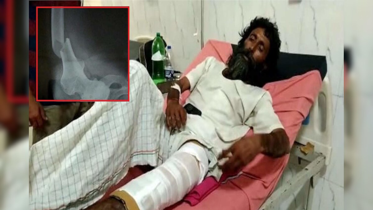 Rajasthan: भरतपुर में साधु ने अवैध शराब बेचने का किया विरोध गुस्साये माफियाओं ने तोड़ डाले पैर