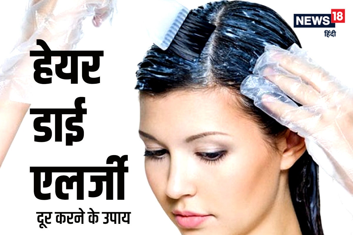 Hair Dye Allergy  Causes Symptoms and Ayurvedic Treatment