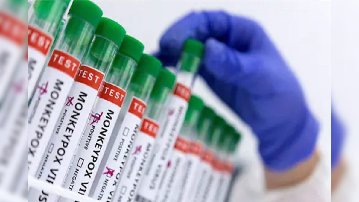 मंकीपॉक्स वैक्सीन पर केंद्र सरकार का बड़ा फैसला टीका बनाने के लिए निकाला टेंडर