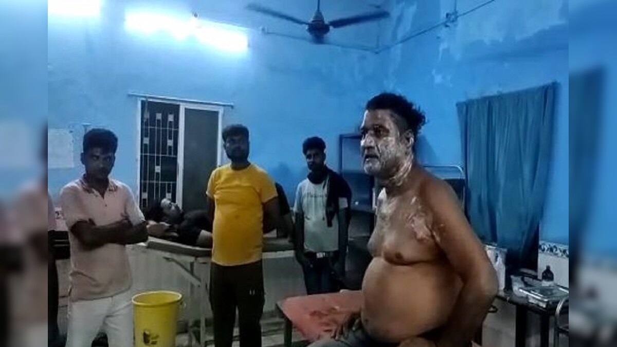 बिहार: पसंद नहीं आया चेहरा और बाल तो डॉक्टर पर कर दिया तेजाब से हमला जानें मामला