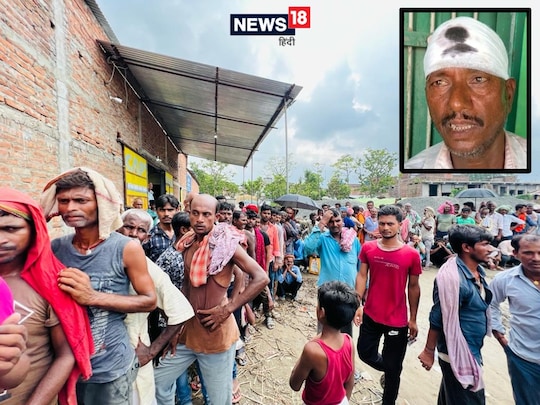 सुबह 7 बजे से खाद के लिए लाइन में लगे थे किसान. (इनसेट में) पुलिस लाठीचार्ज से घायल किसान जीतू सहनी.