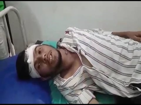 मारपीट की घटना में जख्मी हुआ बीजेपी नेता के जिम का ट्रेनर